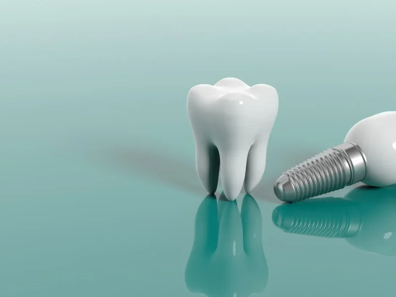 How Dental Implants Enhance Oral Health in Balwyn